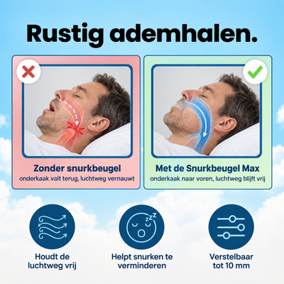 PurelyGoods Snurkbeugel Max